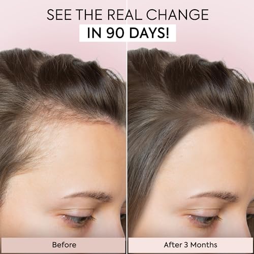 Hair Growth Serum, 1 Fl Oz M23737